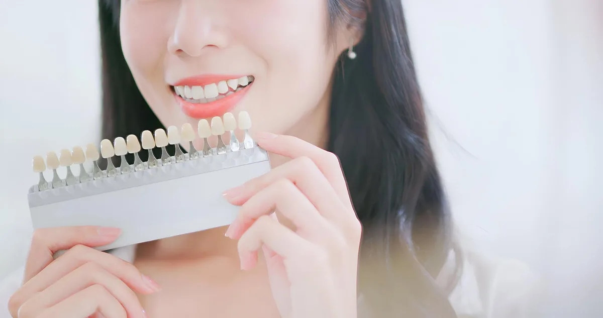 보철 색상을 비교하는 모습 일러스트