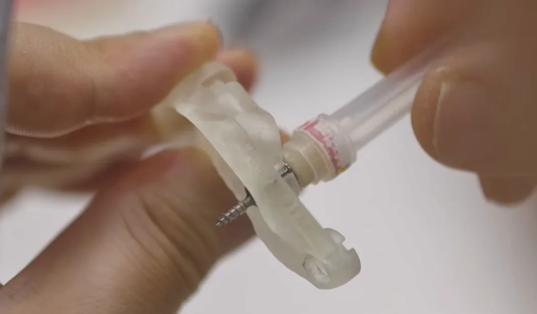 3D프린팅 수술 가이드 실물